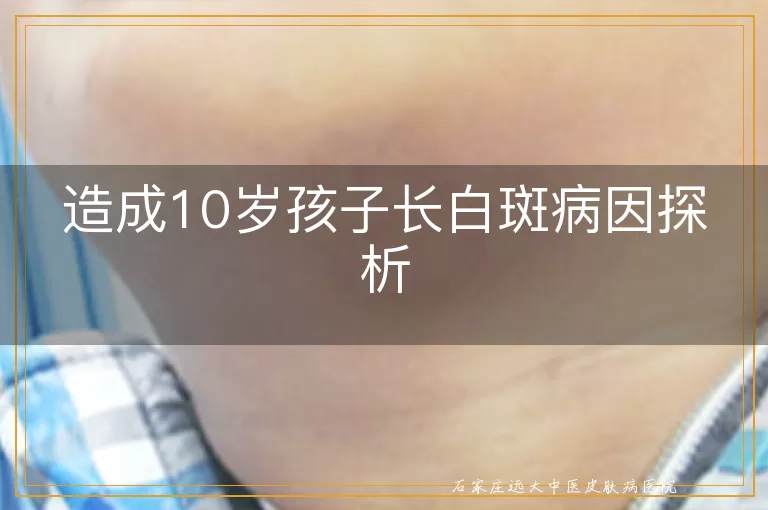造成10岁孩子长白斑病因探析