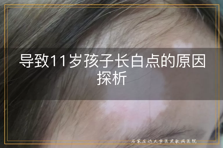 导致11岁孩子长白点的原因探析