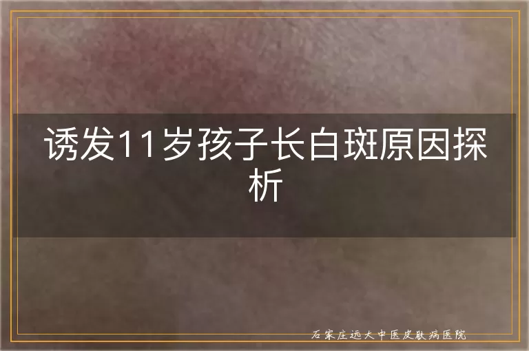诱发11岁孩子长白斑原因探析