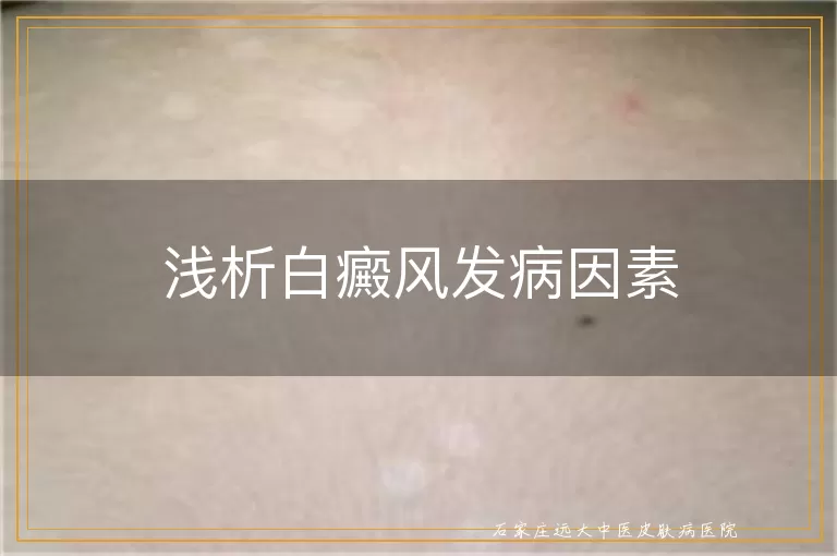 浅析白癜风发病因素