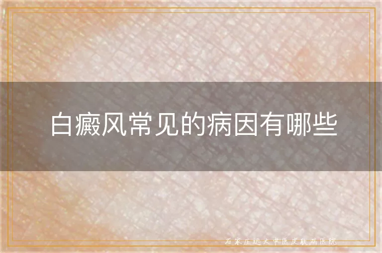 白癜风常见的病因有哪些