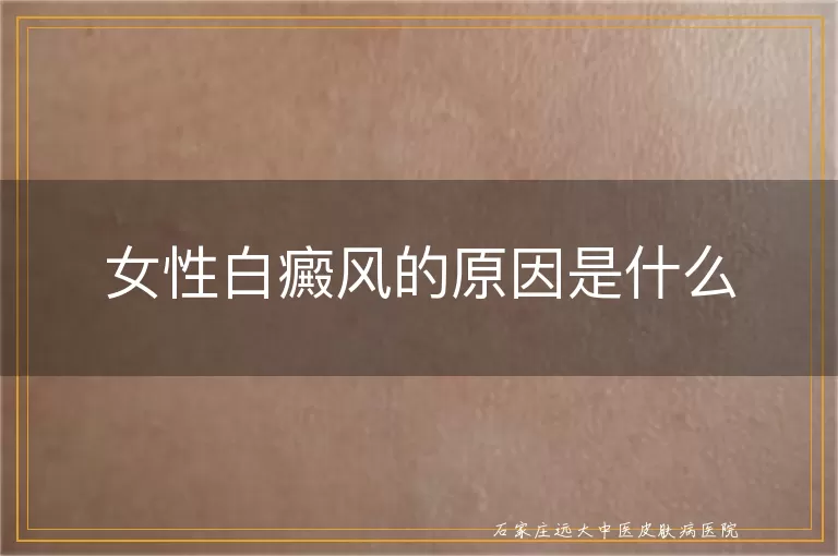 女性白癜风的原因是什么