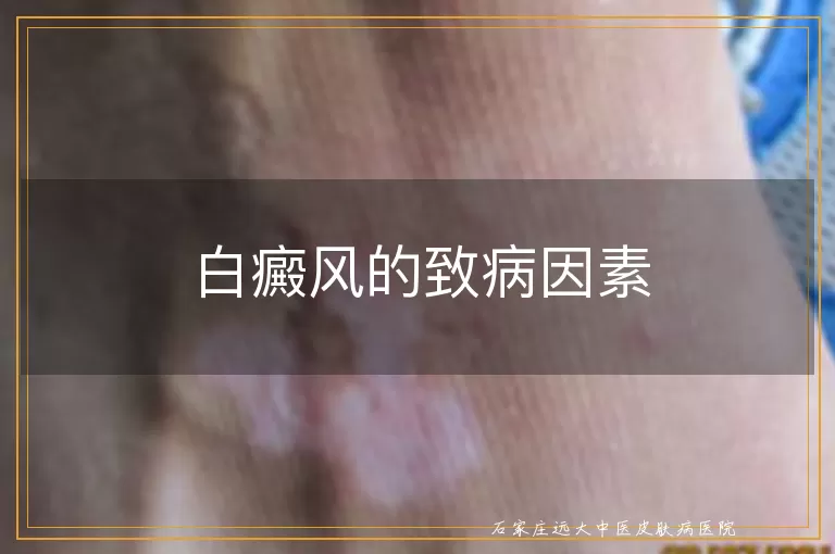 白癜风的致病因素