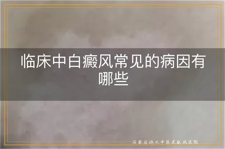 临床中白癜风常见的病因有哪些