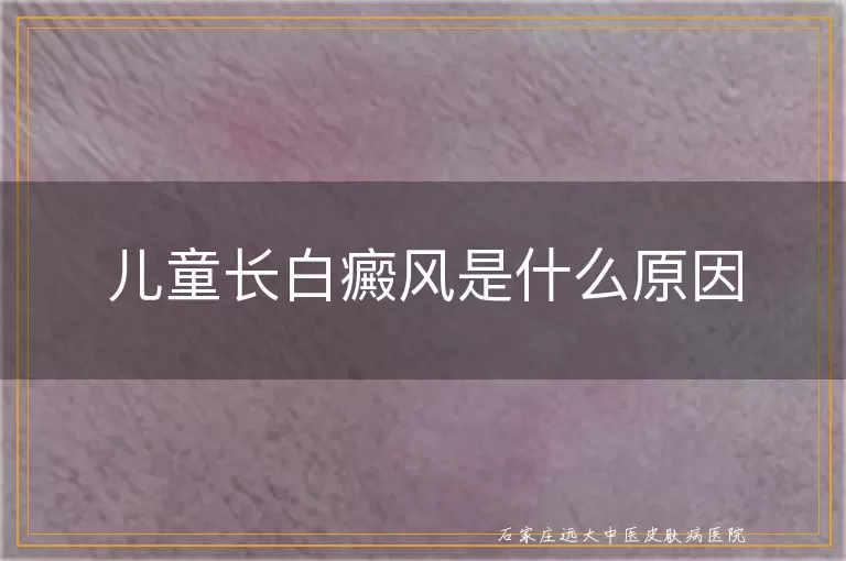 儿童长白癜风是什么原因