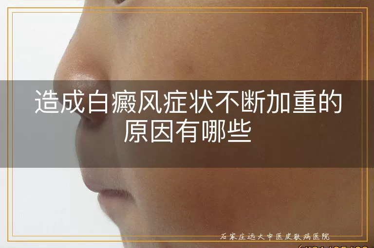 造成白癜风症状不断加重的原因有哪些