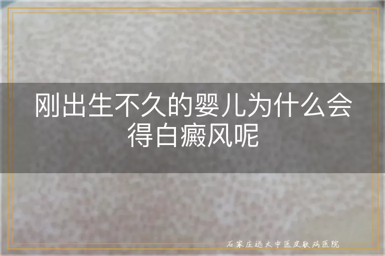 刚出生不久的婴儿为什么会得白癜风呢