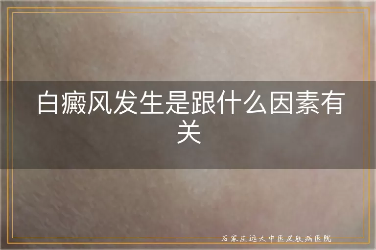 白癜风发生是跟什么因素有关