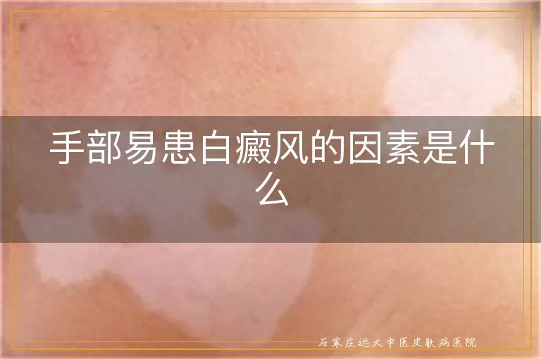 手部易患白癜风的因素是什么