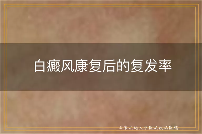 白癜风康复后的复发率