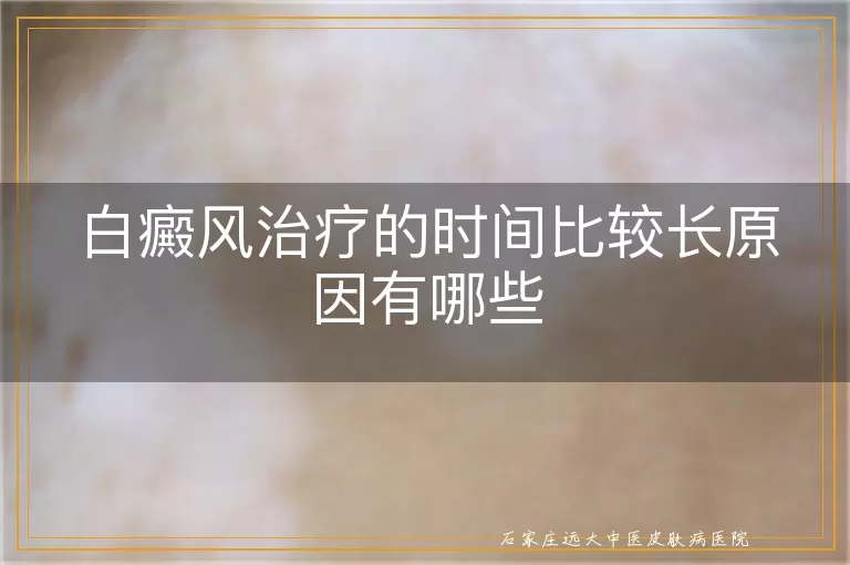 白癜风治疗的时间比较长原因有哪些
