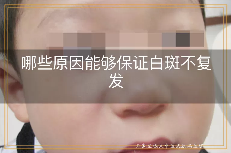 哪些原因能够保证白斑不复发