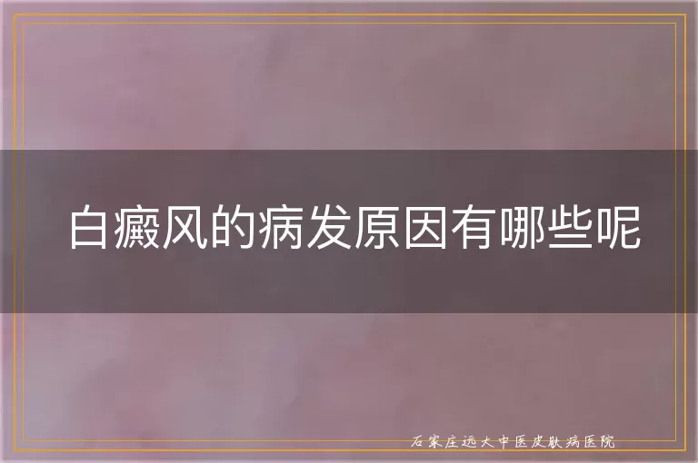 白癜风的病发原因有哪些呢