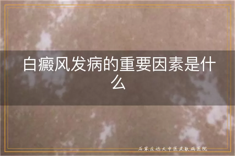 白癜风发病的重要因素是什么