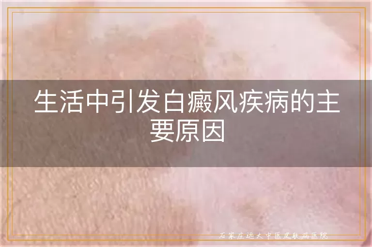 生活中引发白癜风疾病的主要原因