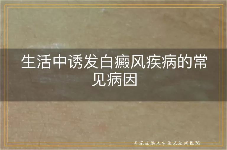 生活中诱发白癜风疾病的常见病因