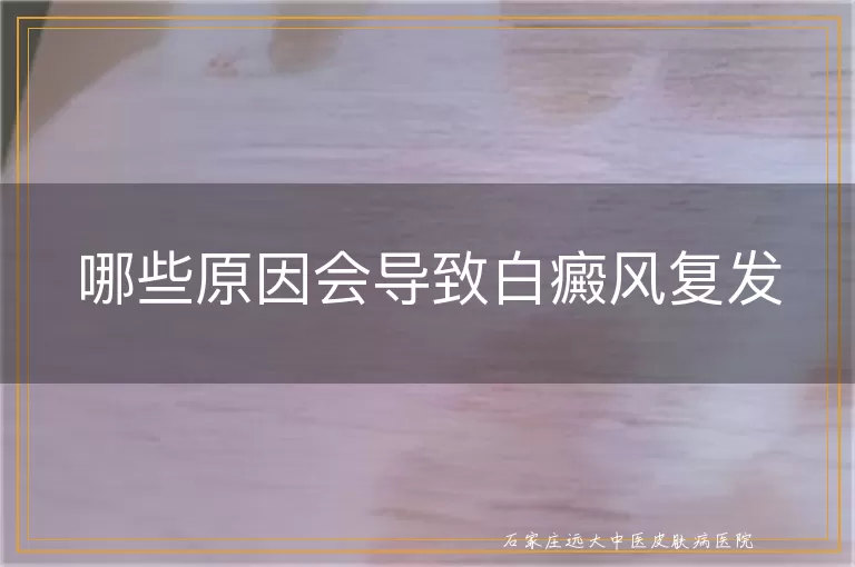 哪些原因会导致白癜风复发