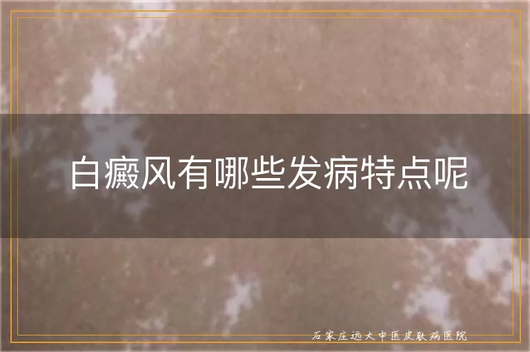 白癜风有哪些发病特点呢