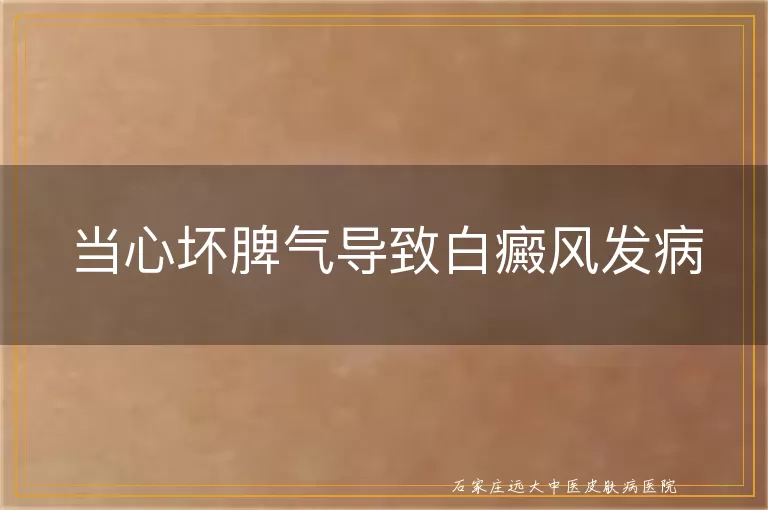 当心坏脾气导致白癜风发病