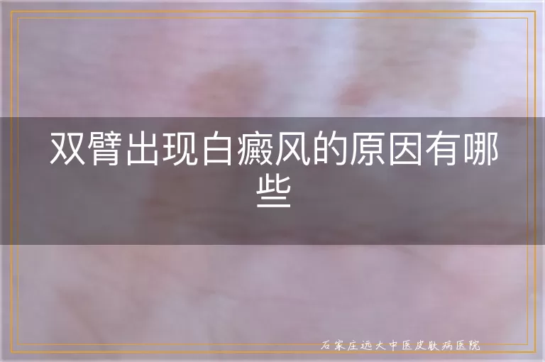 双臂出现白癜风的原因有哪些