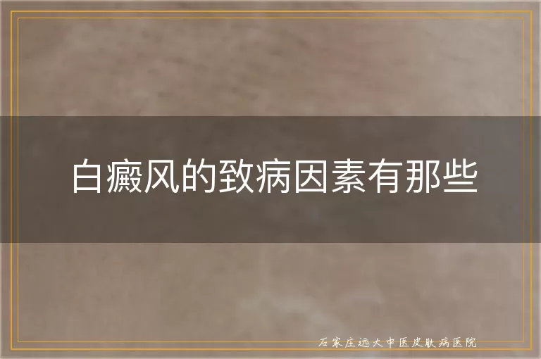 白癜风的致病因素有那些