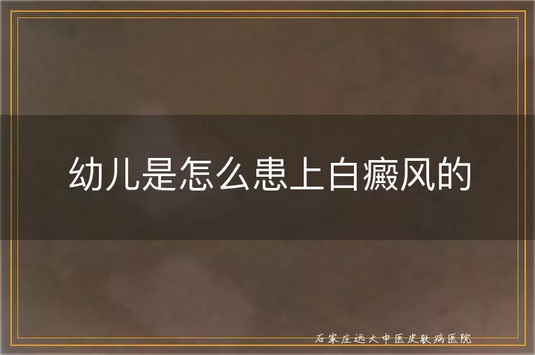 幼儿是怎么患上白癜风的