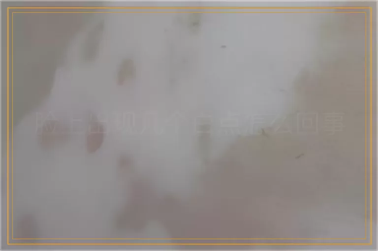 脸上出现几个白点怎么回事