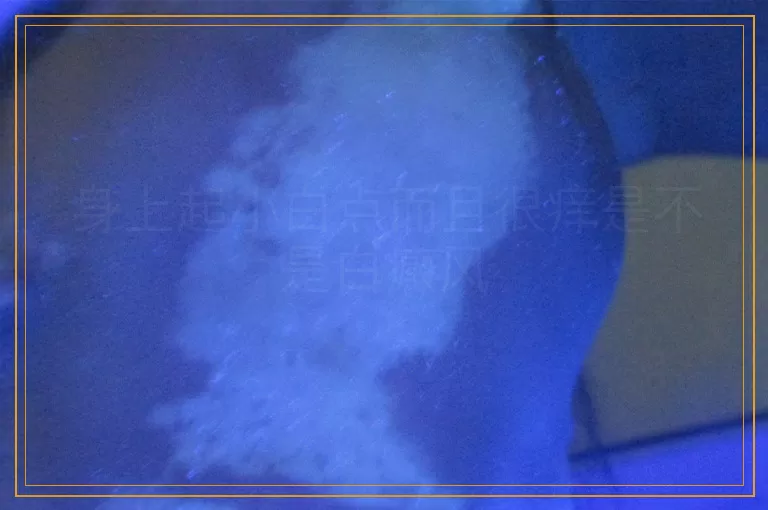 身上起小白点而且很痒是不是白癜风
