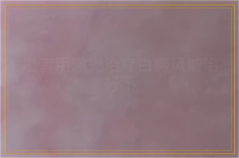 患者用激光治疗白癜风能治好不