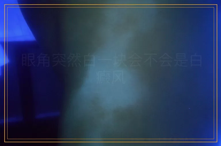 眼角突然白一块会不会是白癜风
