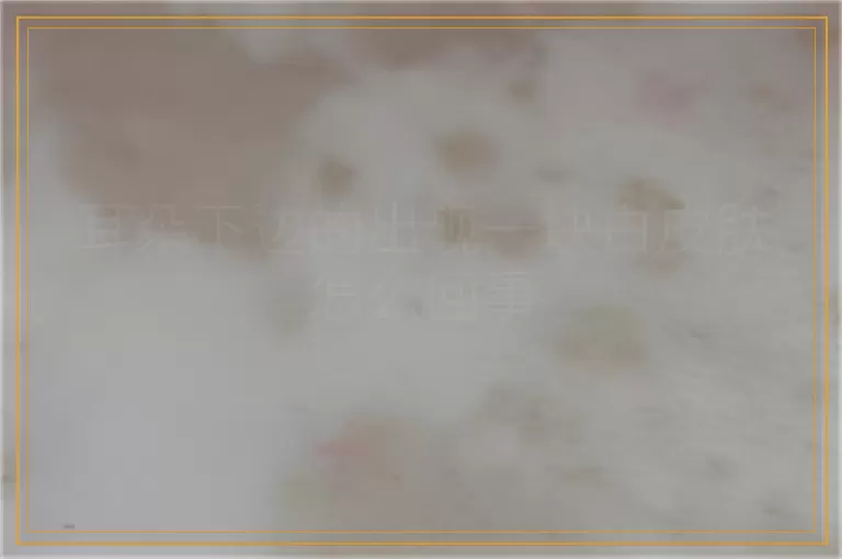 耳朵下边的出现一块白皮肤怎么回事