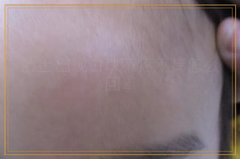 脸上出现白块不疼不痒怎么回事