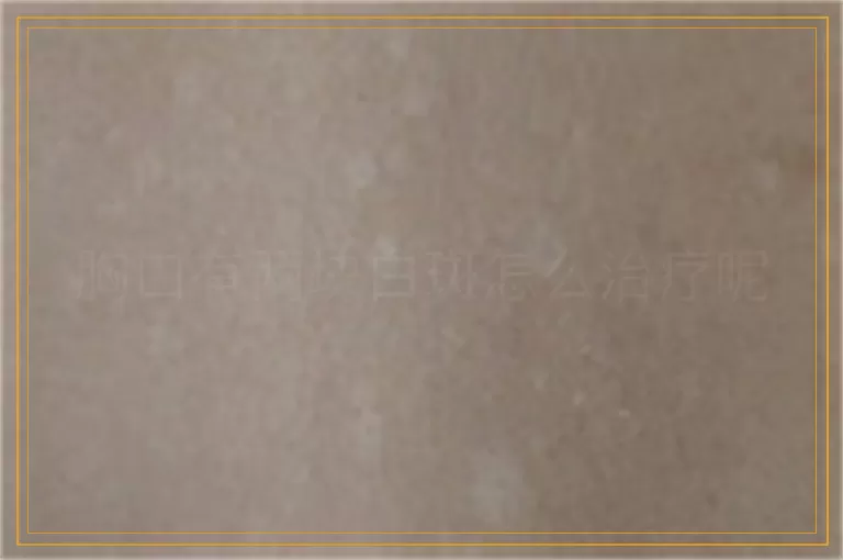 胸口有两块白斑怎么治疗呢