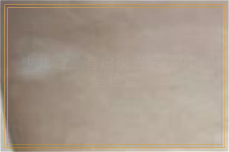 少儿脸上有白斑去医院做哪些检查