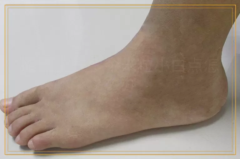 胳膊上长多个米粒小白点怎么办