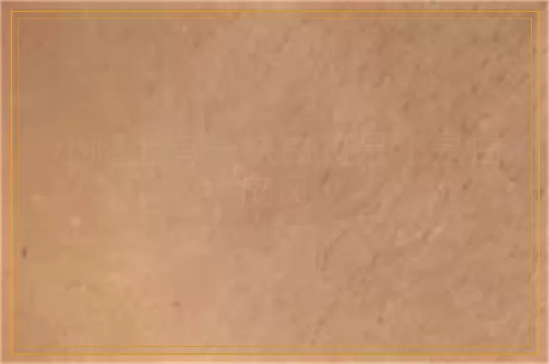 小腿上有一块白斑是不是白癜风