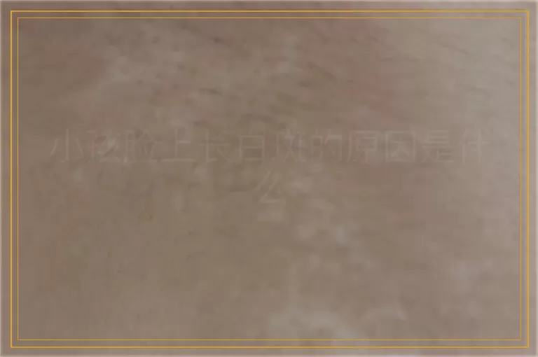 小孩脸上长白斑的原因是什么