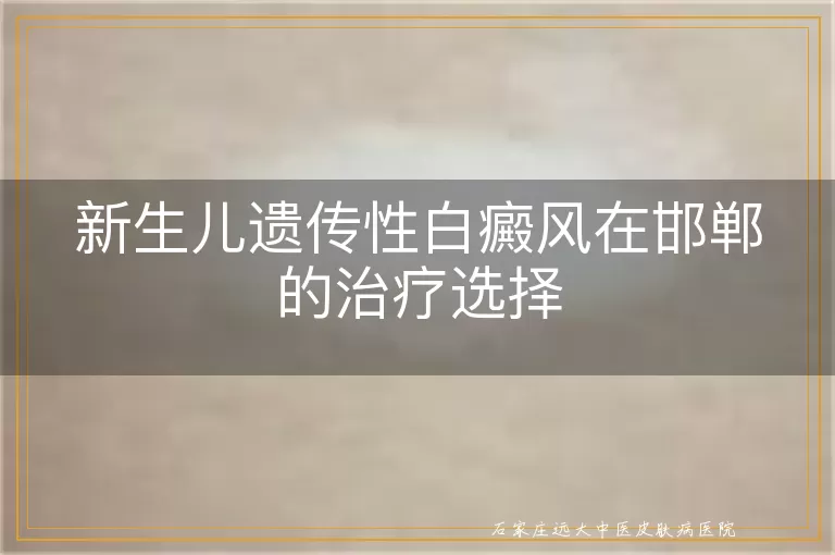 新生儿遗传性白癜风在邯郸的治疗选择