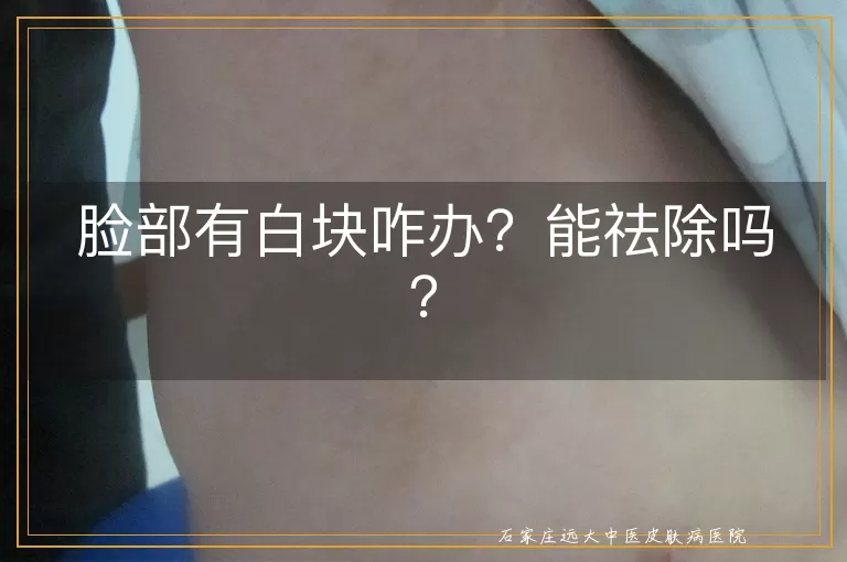 脸部有白块咋办？能祛除吗？