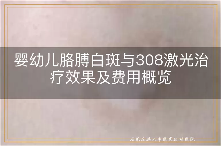 婴幼儿胳膊白斑与308激光治疗效果及费用概览