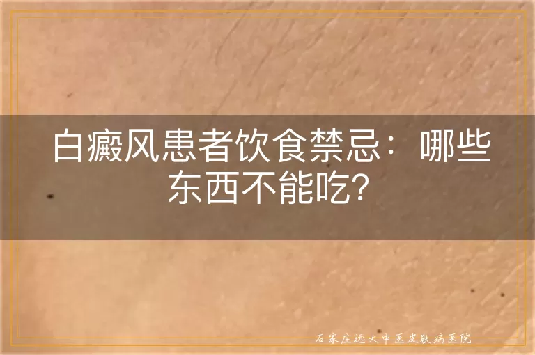 白癜风患者饮食禁忌：哪些东西不能吃？