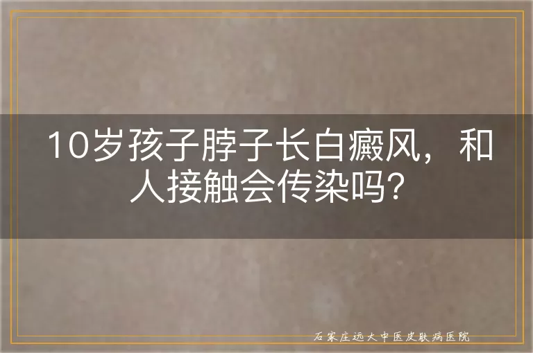 10岁孩子脖子长白癜风，和人接触会传染吗？