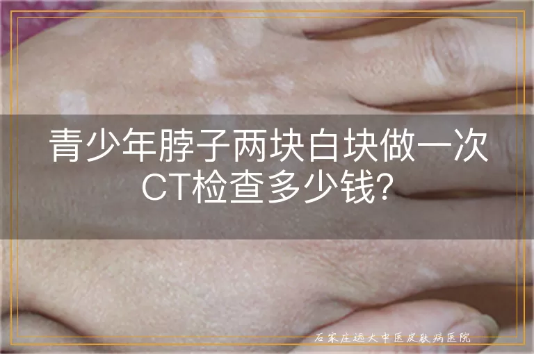 青少年脖子两块白块做一次CT检查多少钱？