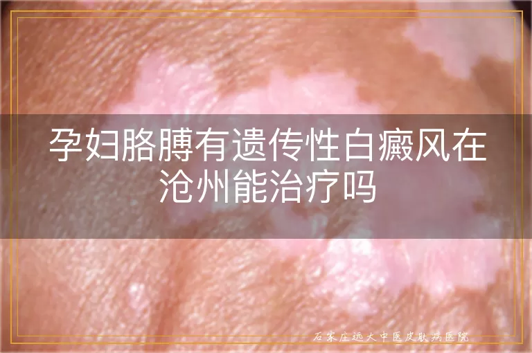 孕妇胳膊有遗传性白癜风在沧州能治疗吗