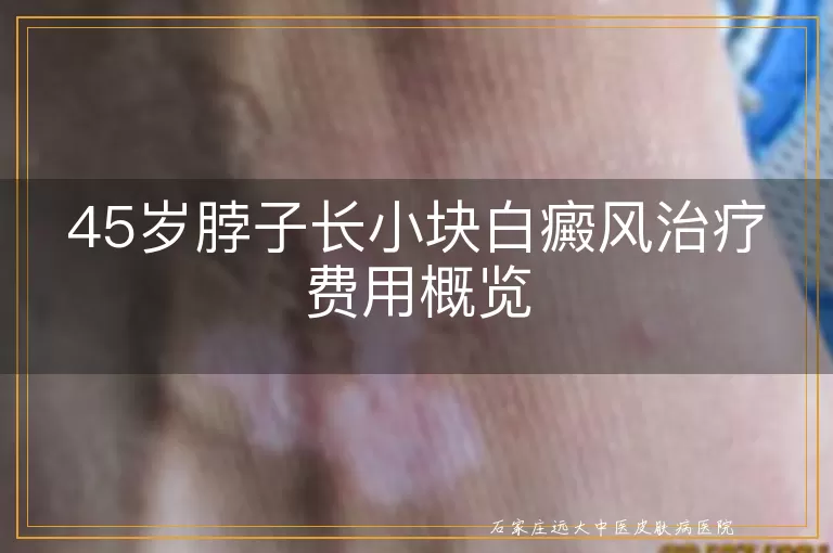 45岁脖子长小块白癜风治疗费用概览