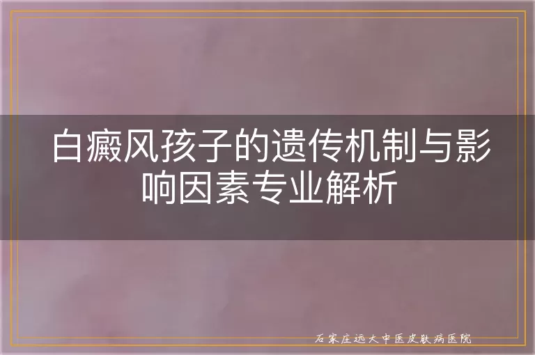 白癜风孩子的遗传机制与影响因素专业解析