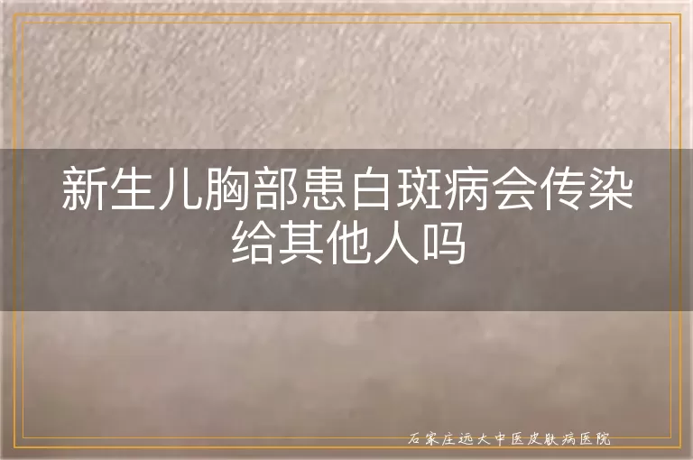 新生儿胸部患白斑病会传染给其他人吗