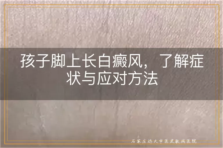 孩子脚上长白癜风，了解症状与应对方法