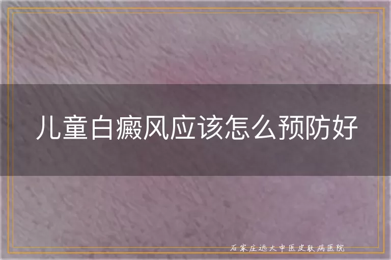 儿童白癜风应该怎么预防好