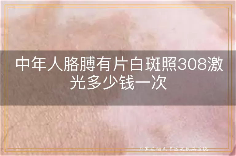 中年人胳膊有片白斑照308激光多少钱一次